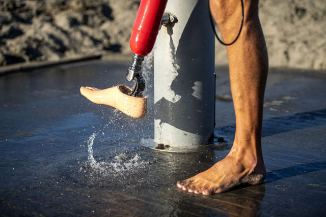 Artificial limbs